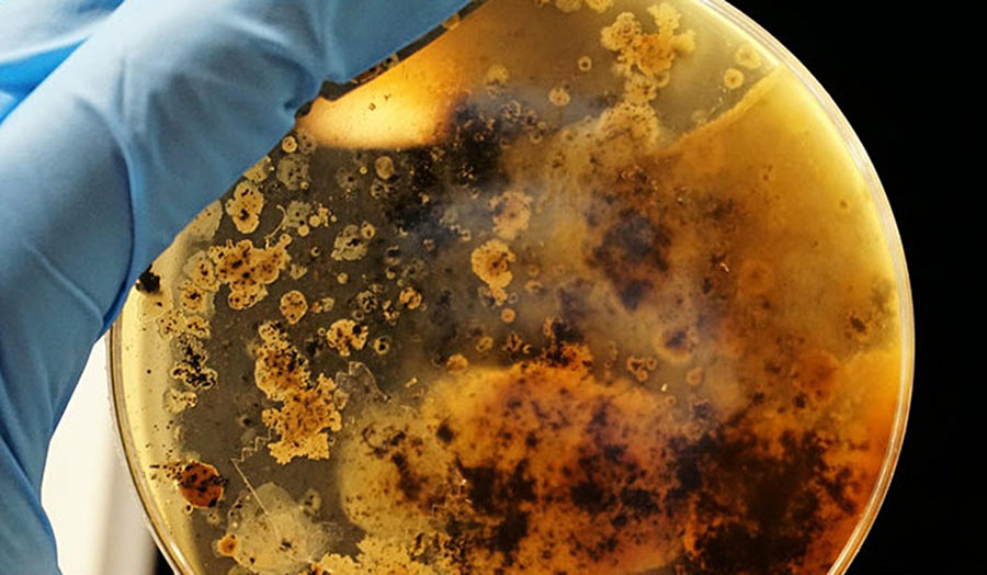 Close-up of a hand wearing a medical glove holding a cylinder with cells in an amber liquid